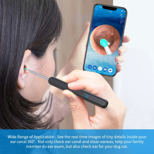 ClearView Smart Ear Cleaner